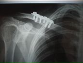 Фотография Устинова Александра