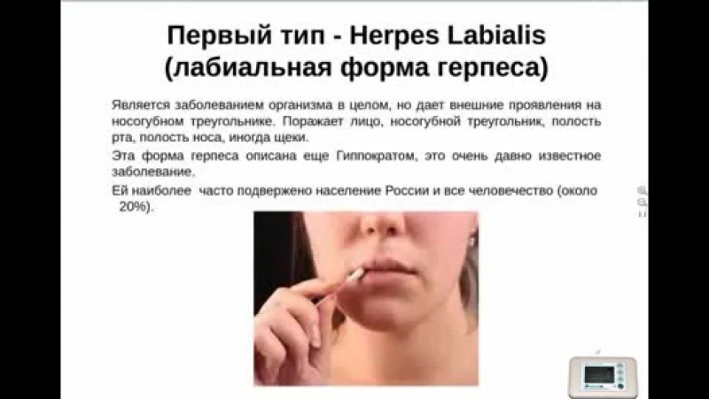 Можно Ли Оральный Секс При Герпесе
